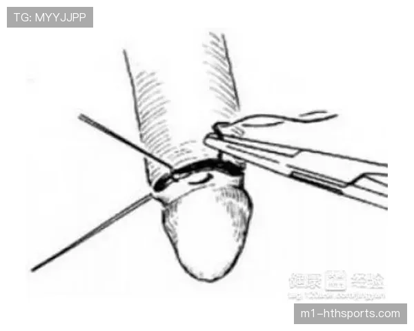 杰威手腕接受复查手术，预计两周后进行健康评估